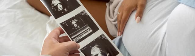 Jak wyliczyć dzień porodu? Metody, które zaskoczą przyszłych rodziców Jak wyliczyć dzień porodu? Metody, które zaskoczą przyszłych rodziców